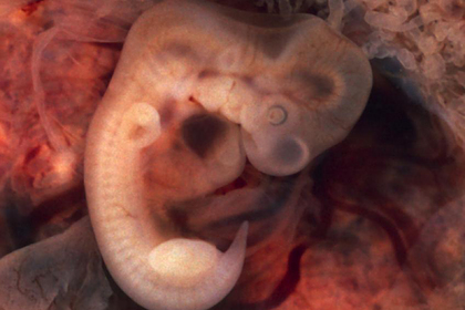 Разрешены длительные эксперименты на эмбрионах человека