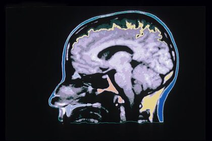 Ученые обнаружили указывающие на признаки рака &laquo;горячие точки&raquo; в мозгу