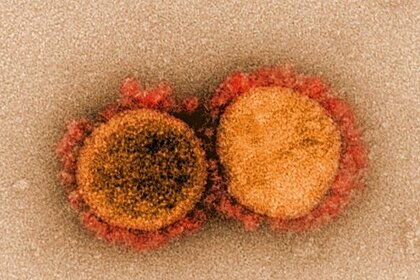 Разработан революционный способ лечения коронавируса с помощью наноловушек