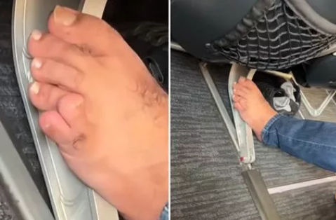 Турист выложил свою оголенную шестипалую ногу в самолете и вызвал отвращение и возмущение пассажиров